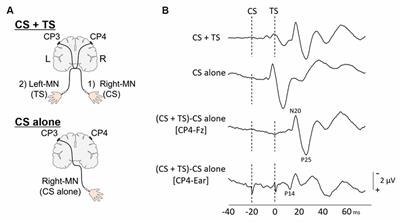 Contralateral and Ipsilateral Interactions in the Somatosensory Pathway in Healthy Humans